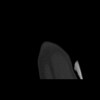 SPORK, NICO - 22.03.1976 - 02.08.2022 - CT obere Extremität - 18:01:28